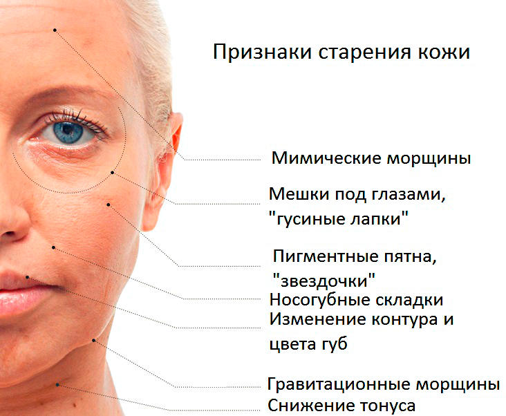 Признаки старения кожи лица